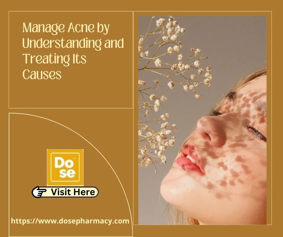 How to Treat Different Types of Acne